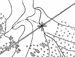 [Figure 15. Road block position - Wrong]